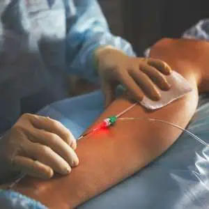 endovenous laser ablation evla treatment